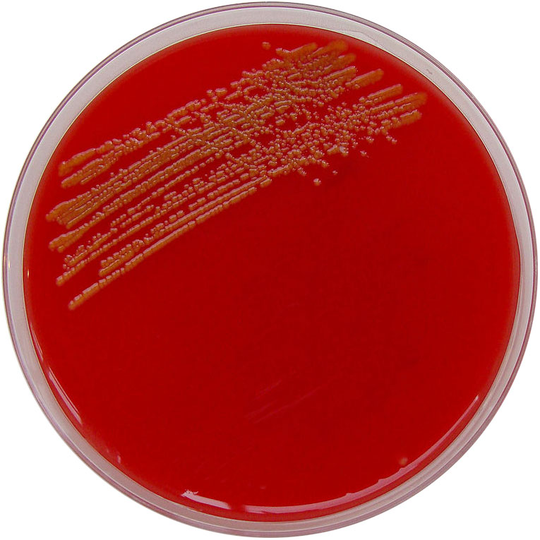 Petrie dish for growing bacteria